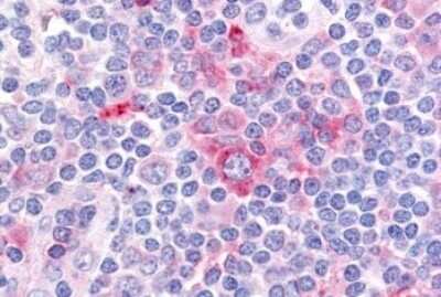 Immunohistochemistry-Paraffin: GPR62 Antibody [NBP3-14362] - Immunohistochemistry of formalin-fixed, paraffin-embedded human tonsil after heat-induced antigen retrieval.